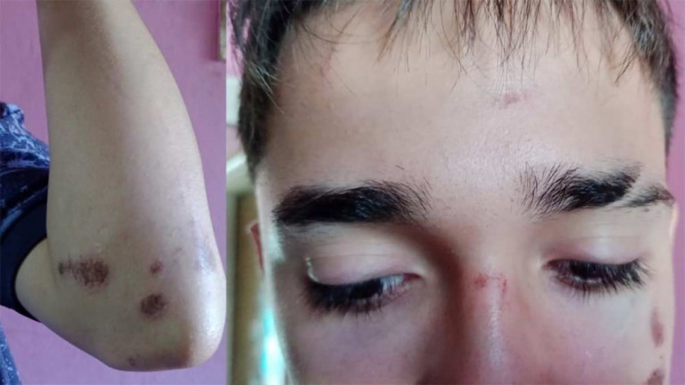 Otro ataque a la salida de un boliche: una patota agredió a un joven que esperaba un remís en Cañuelas
